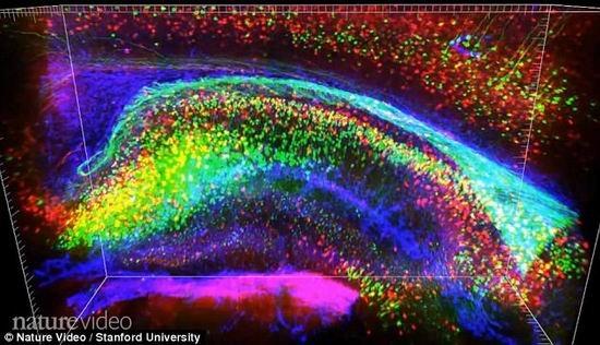 微芯片植入大脑可保存人们的大脑记忆内容